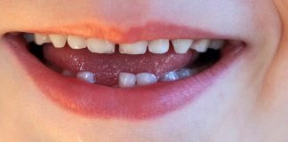 Zahngesundheit bei Kindern ist Thema des Online-Seminars. Foto: Pixabay