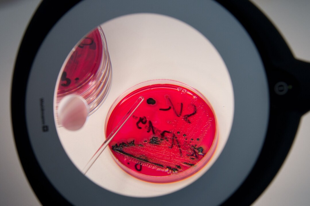 In einem Labor werden Salmonellen in einer Petrischale gezeigt.