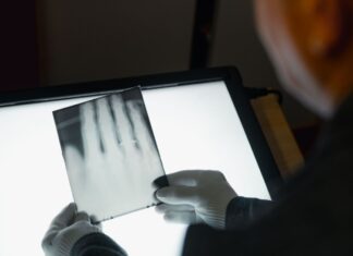 Ein Röntgenbild der Hand von Wilhelm Röntgen gehört nun zum  Unesco-Weltdokumentenerbe. (Archivbild)