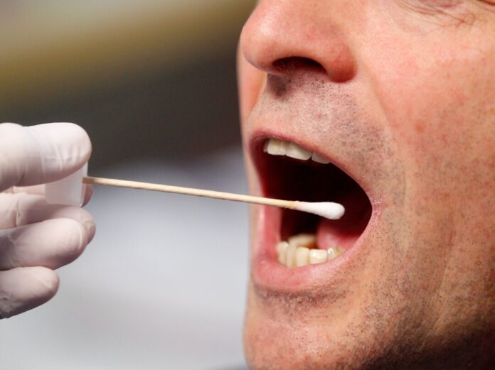 DNA-Speicheltest Die Polizei will mit einer DNA-Reihenuntersuchung und einer Belohnung einen mehr als 20 Jahre alten Mordfall aufklären. (Symbolbild)