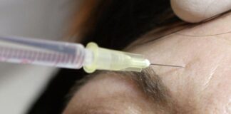 Am BGH geht es um sogenannte minimalinvasive Schönheitsbehandlungen. (Symbolbild)