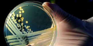 Die Zahl der registrierten Ehec-Fälle steigt in NRW. Das Landesamt für Gesundheit führt diesen Trend auf eine bessere Diagnostik zurück. (Archivbild)