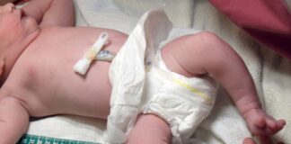 In den vergangenen Jahren ist die Zahl der Geburtskliniken in NRW immer weiter zurückgegangen. Die Lage könnte sich nun weiter verschärfen, fürchten Hebammen (Symbolbild).