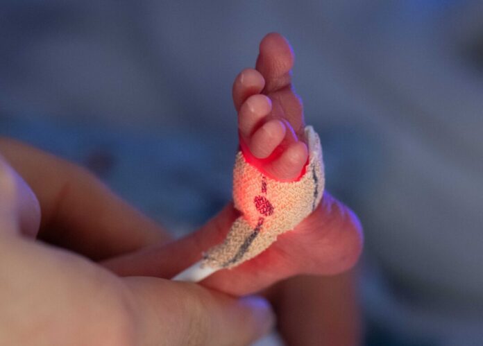 Darmkeim-Infektionen in Kinderklinik: Frühchen gestorben Darmkeim-Infektionen können vor allem für besonders vulnerable Patienten, wie etwa Frühchen, gefährlich werden. (Symbolbild)
